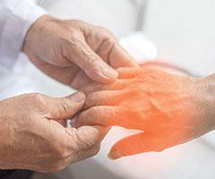 Hand pain examination